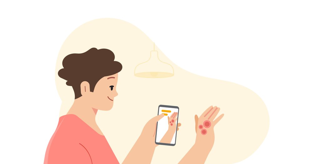 Google To Launch AI Tool That Can Help Identify Skin Problems Via Phone Camera