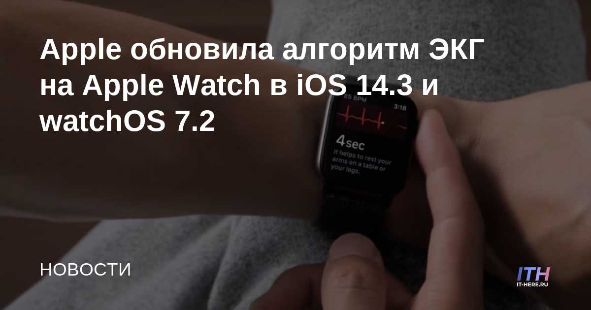Apple actualiza el algoritmo de ECG en Apple Watch en iOS 14.3 y watchOS 7.2
