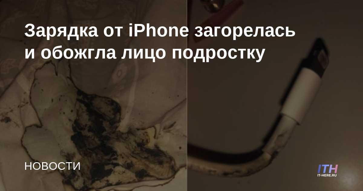 Cargador de iPhone se incendió y quemó la cara de un adolescente