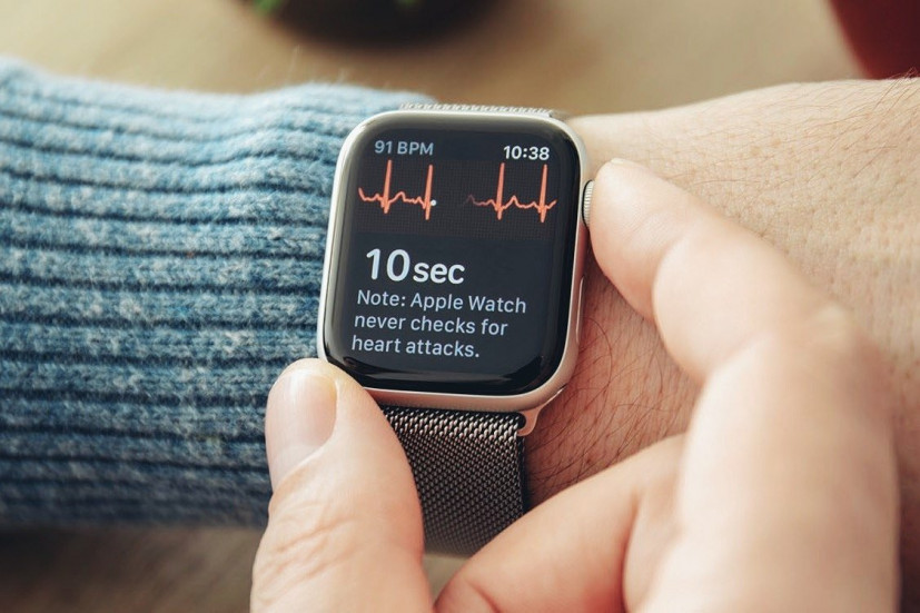 Pronto Apple Watch hará mejores ECG: cuándo, cómo y en qué modelos