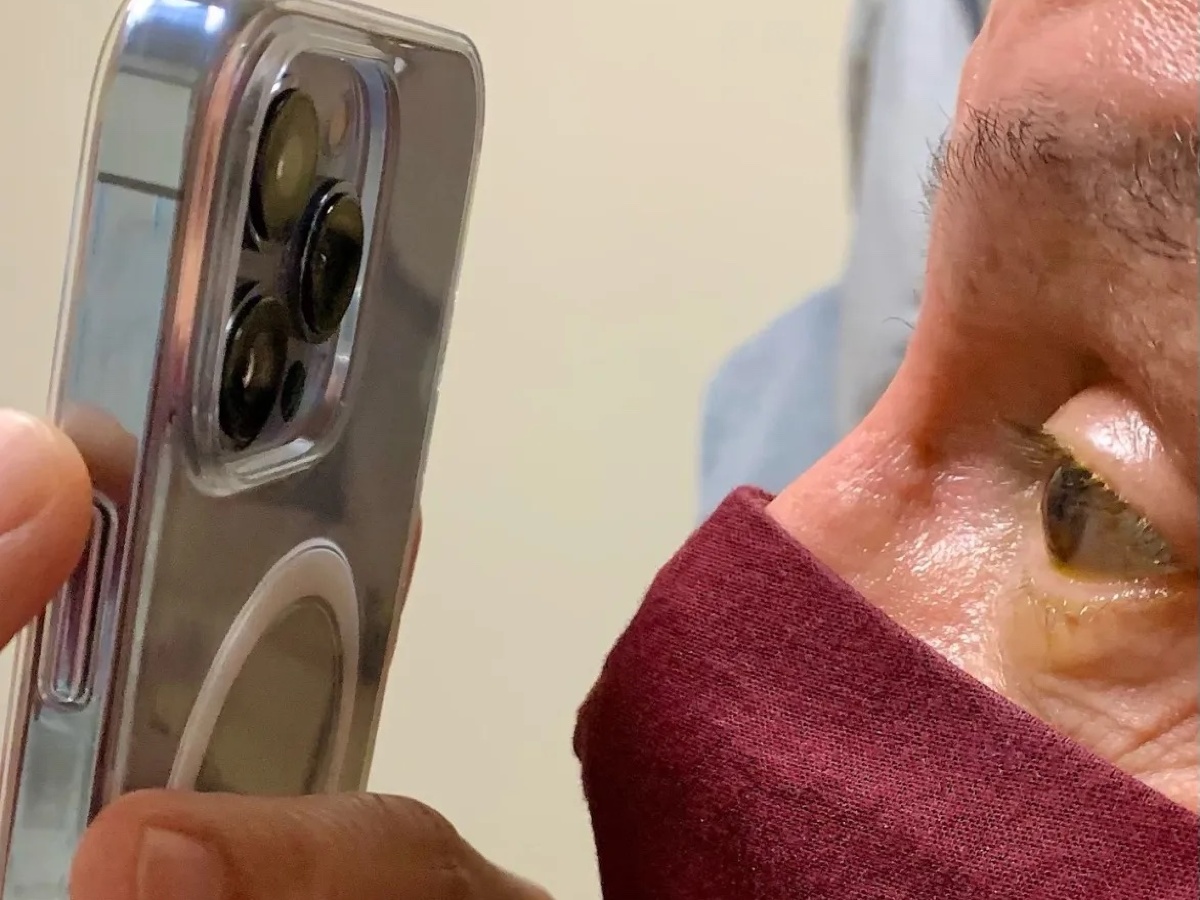 El oftalmólogo utiliza el modo macro del iPhone 13 Pro Max para realizar un seguimiento de los pacientes