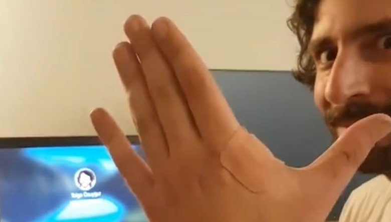 YouTuber turco pone un chip inalámbrico debajo de su piel