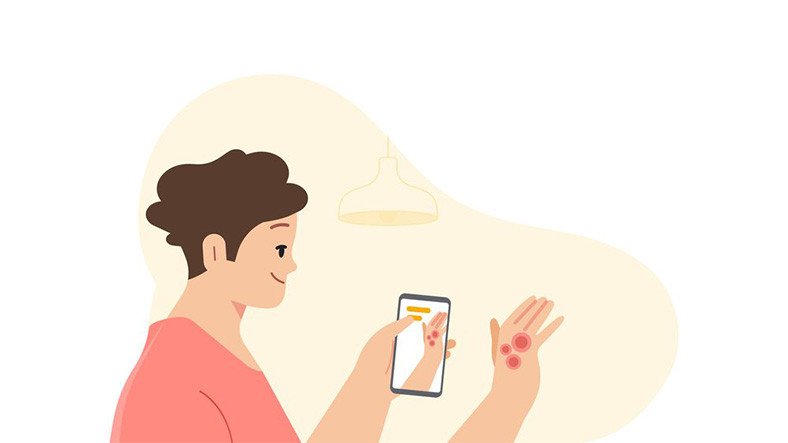 Google presenta su nueva aplicación enfocada en dermatología